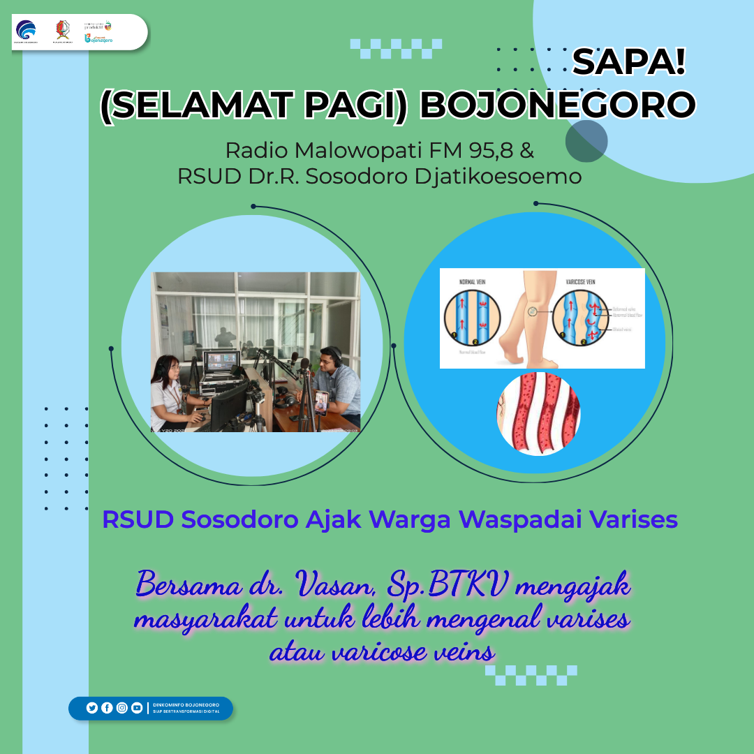 Lewat SAPA Malowopati, Pemkab Bojonegoro Ajak Warga Waspadai Varises
